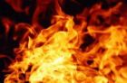 При пожаре в Арзамасском районе пенсионерка получила ожоги 40% тела